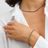 שרשרת סטוני פורסט