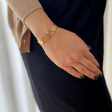 צמיד אמרסון